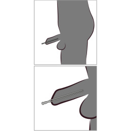 Hollow Dilator